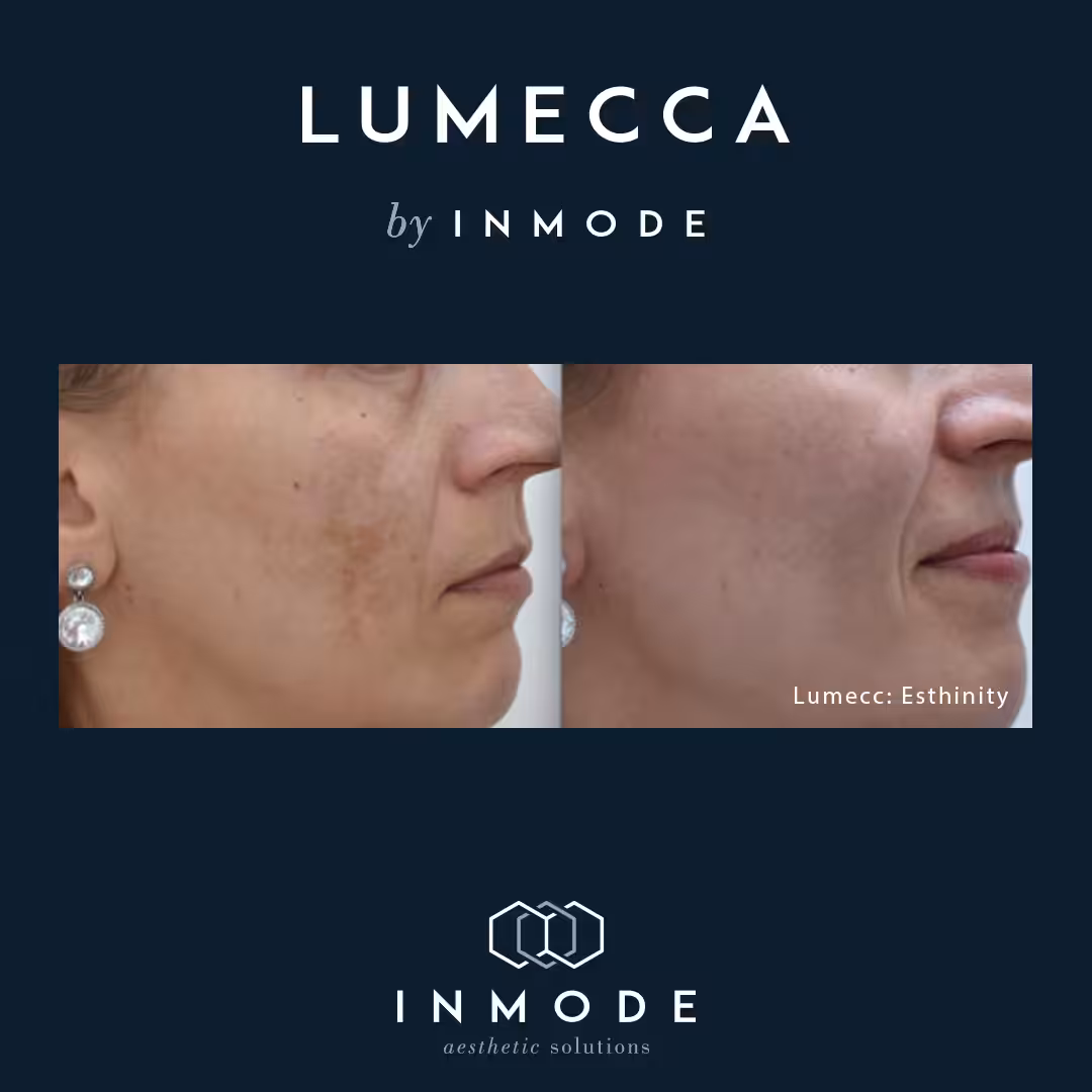 Medizinische Kosmetik Zürich