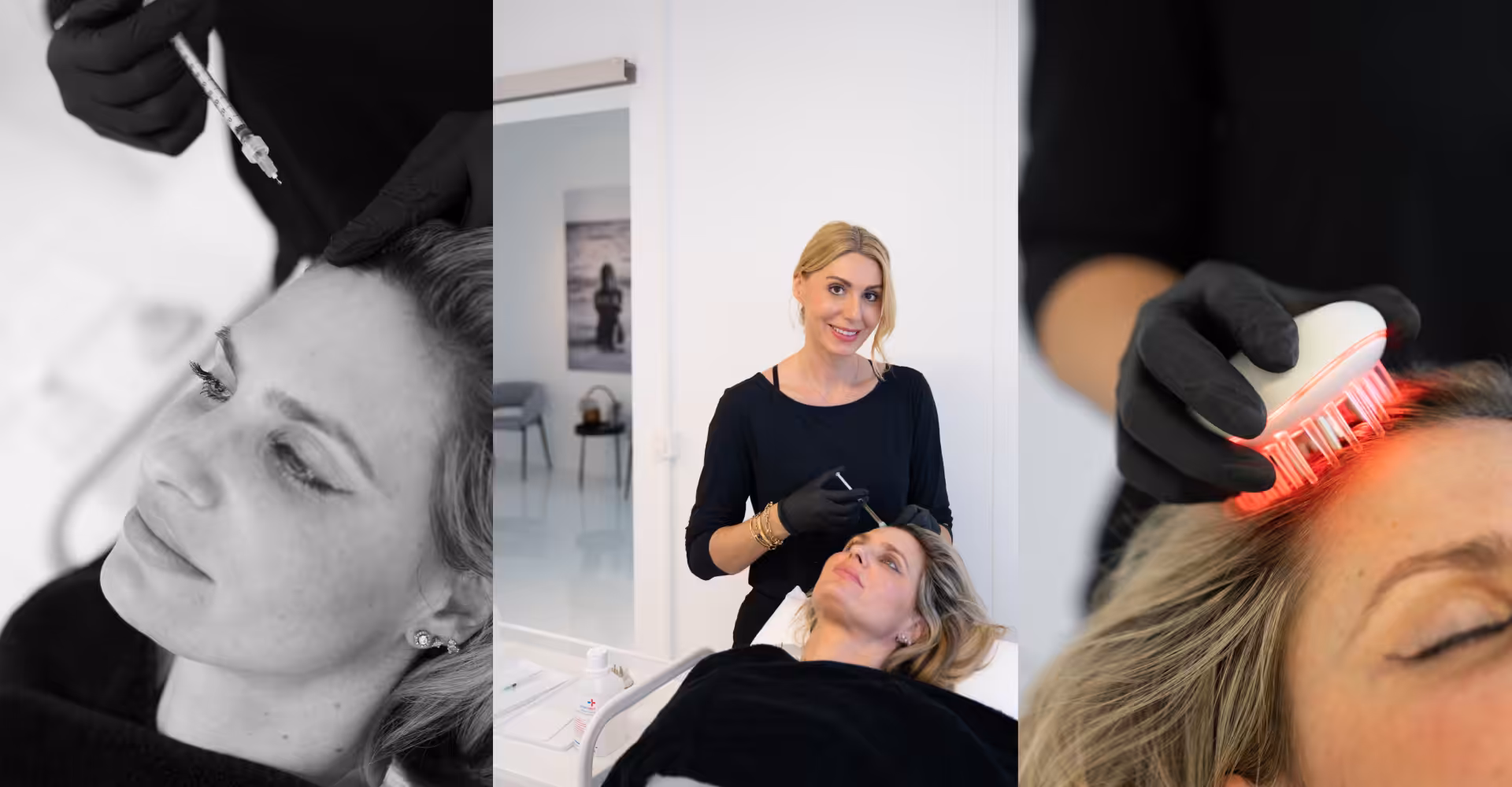 Hair Restart: Fotona 4D with PRP