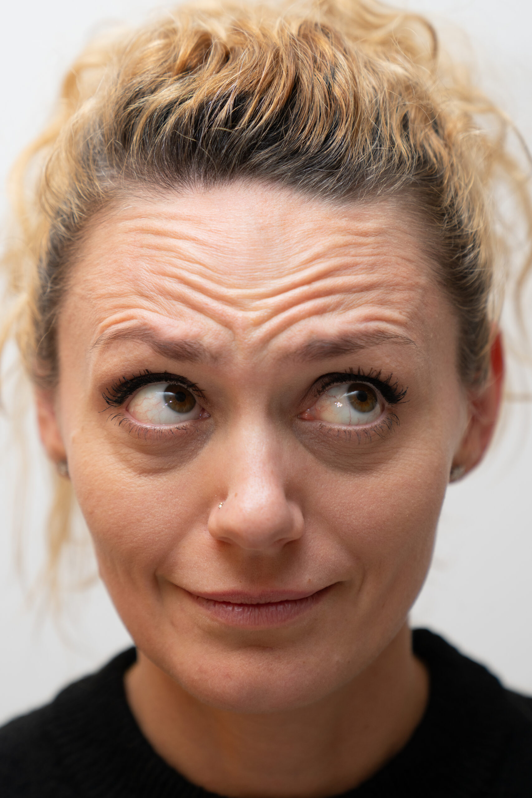 Botulinumtoxin Behandlung Switzerland