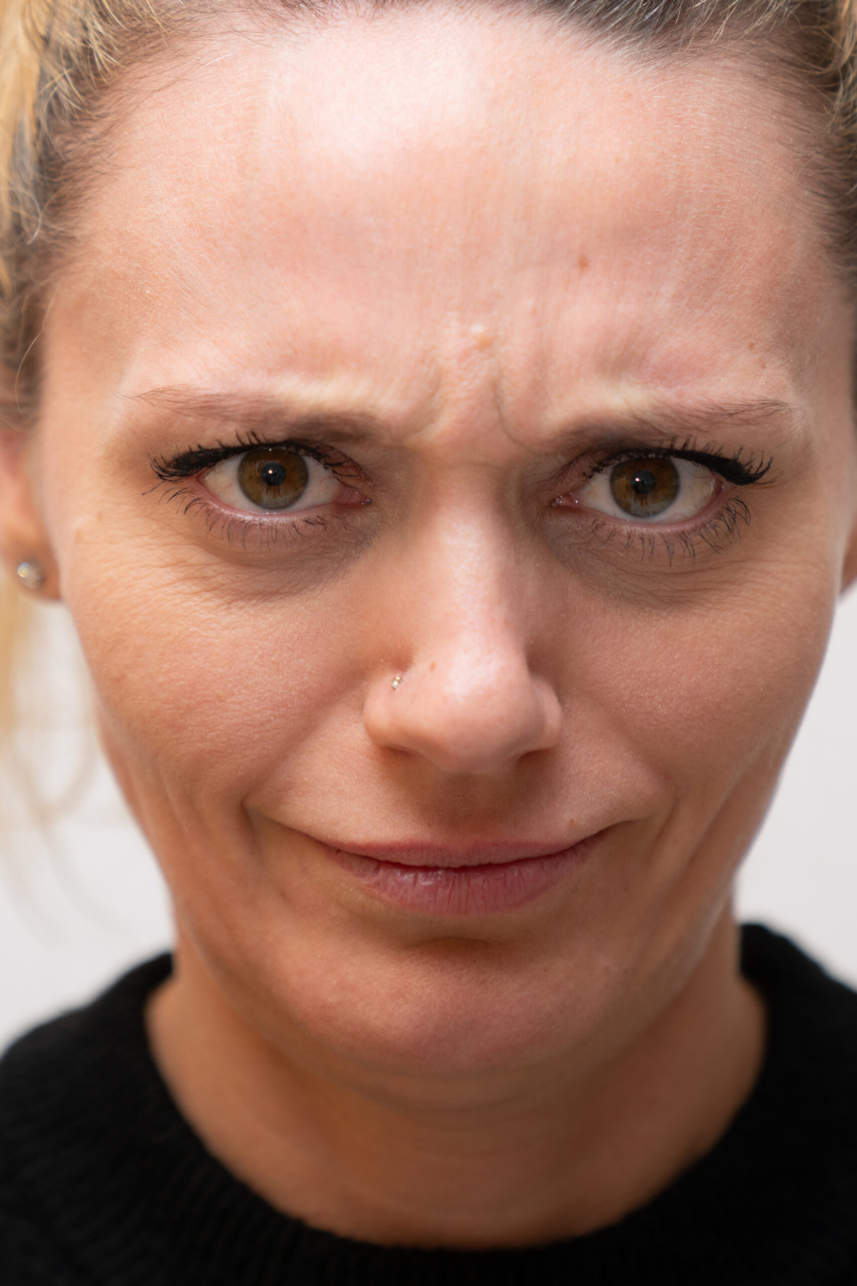Botulinumtoxin Behandlung Zuerich Kilchberg