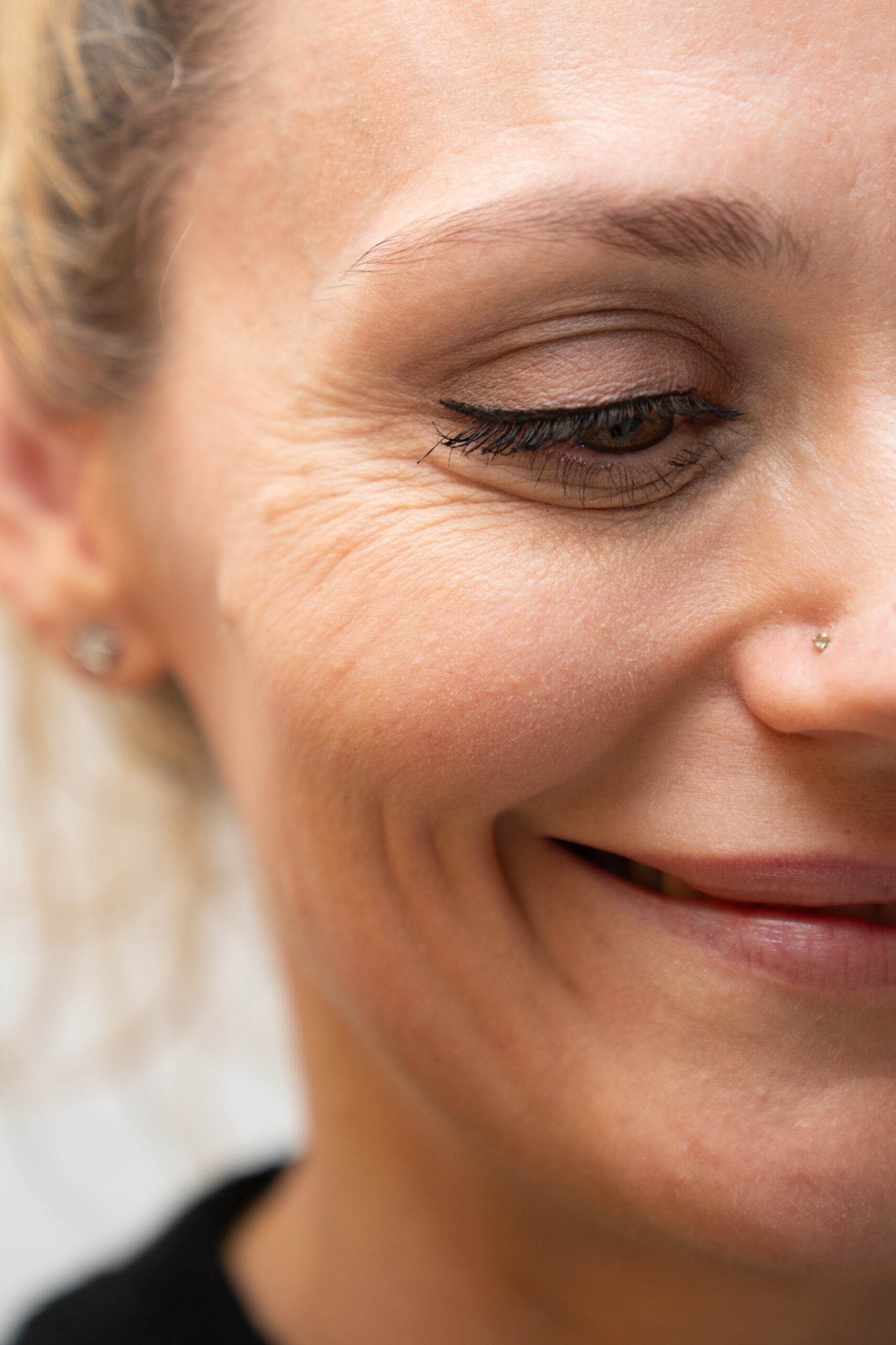 Botulinumtoxin Behandlung Zuerich
