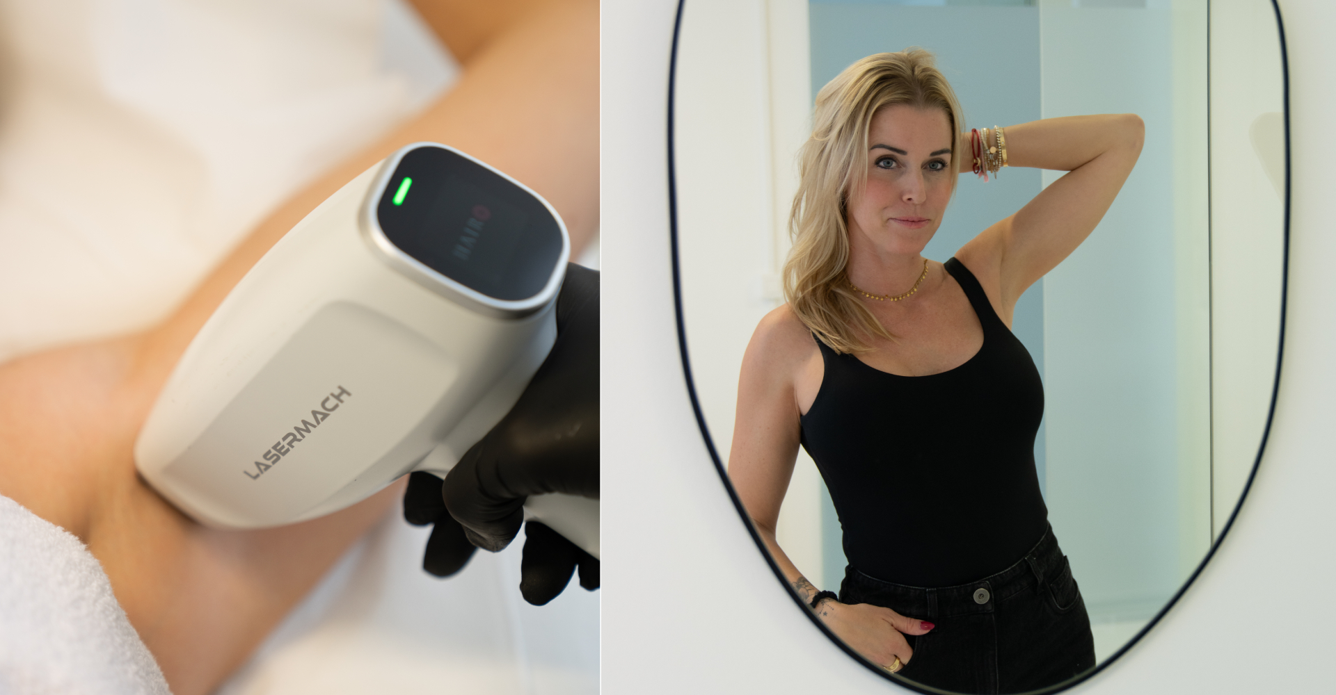 Wie funktioniert eine Laser-Haarentfernung im Skin Atelier Kilchberg